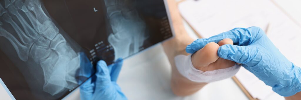 Rayos x de pie urgencias traumatologicas